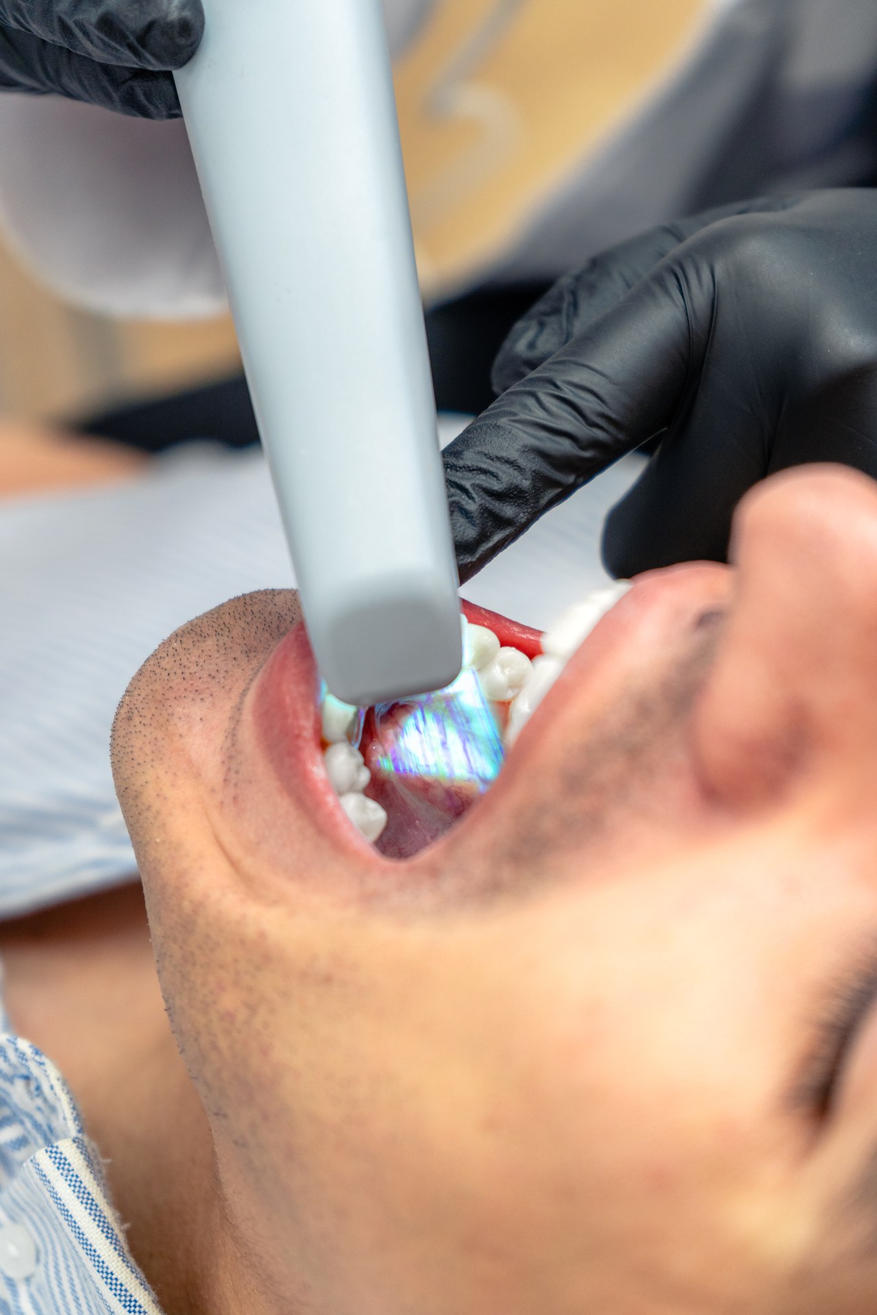 Proceso de escaneo digital 3D intraoral